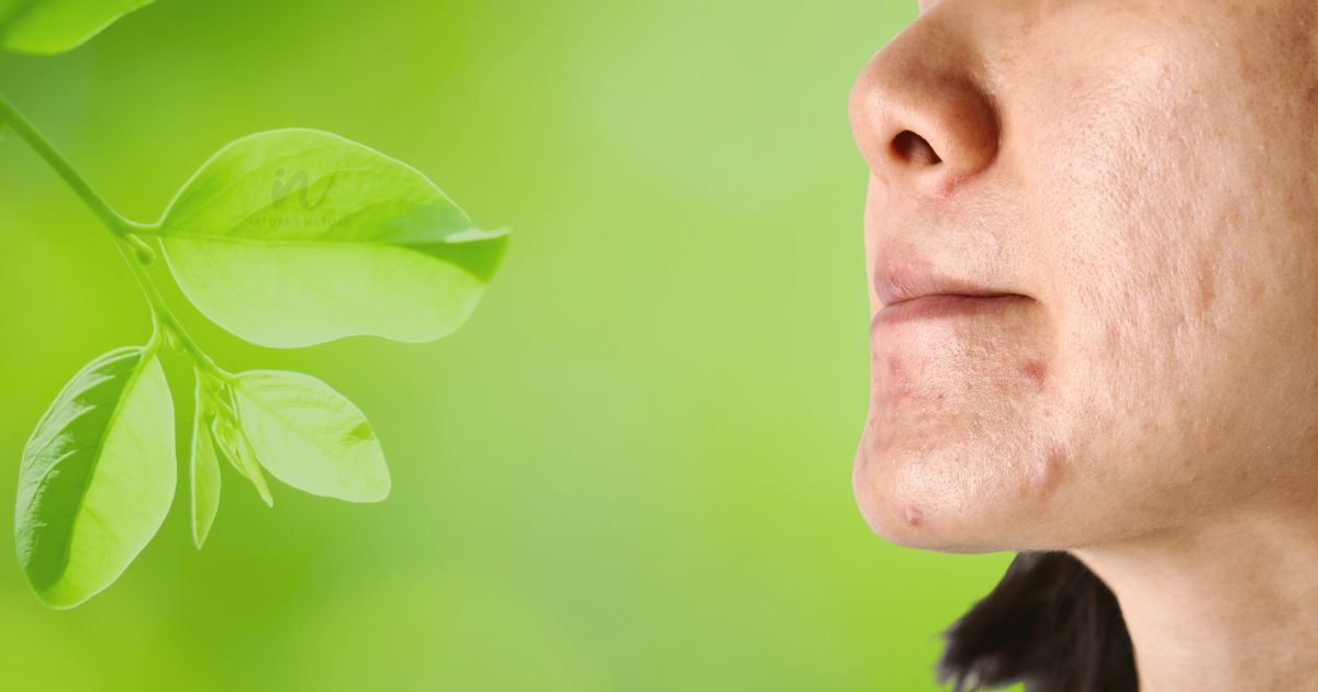 How to Repair Damaged Skin? Simple Steps for Healthy Skin