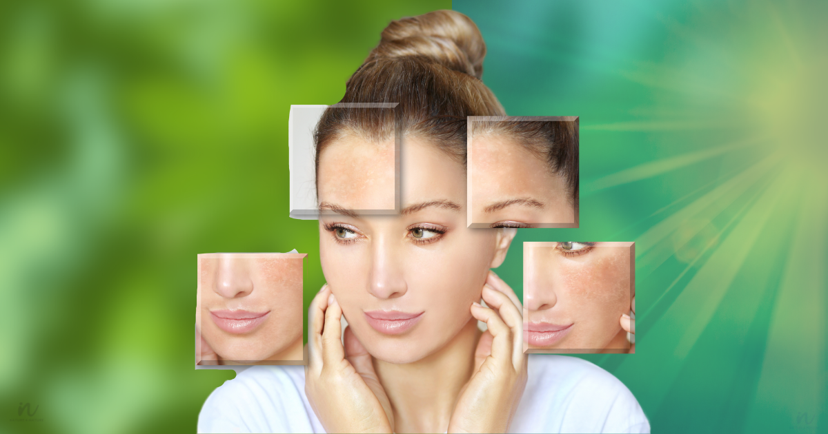 How to repair Sun damaged skin or face naturally?