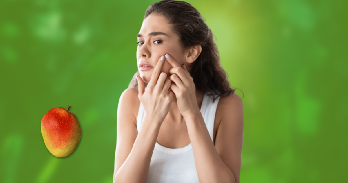Does Mango cause Acne? Yes, Mangoes do causes acne but