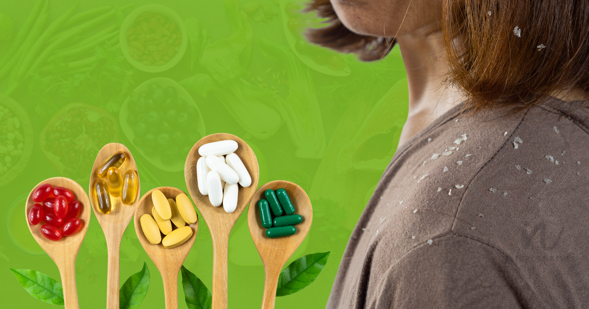 6 Common Signs of vitamin deficiency that causes dandruff?