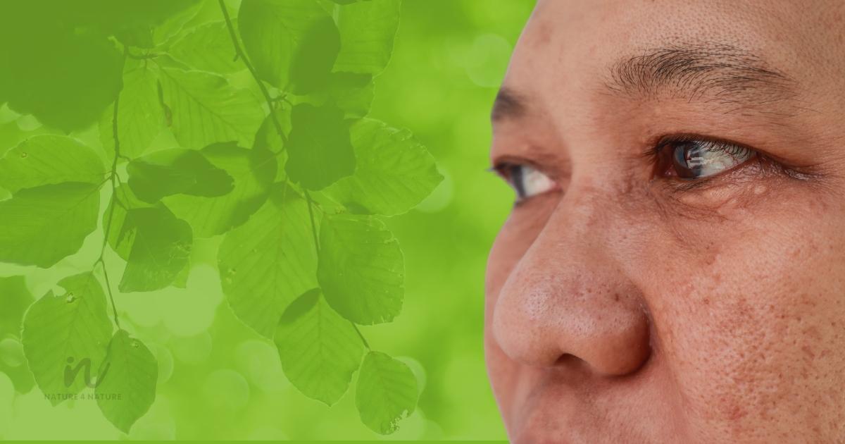 how to remove dark spots for men?