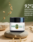 Anti Acne Cream with Herbal Actives for Clear Skin